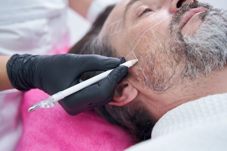 White piedra symptoms on hair