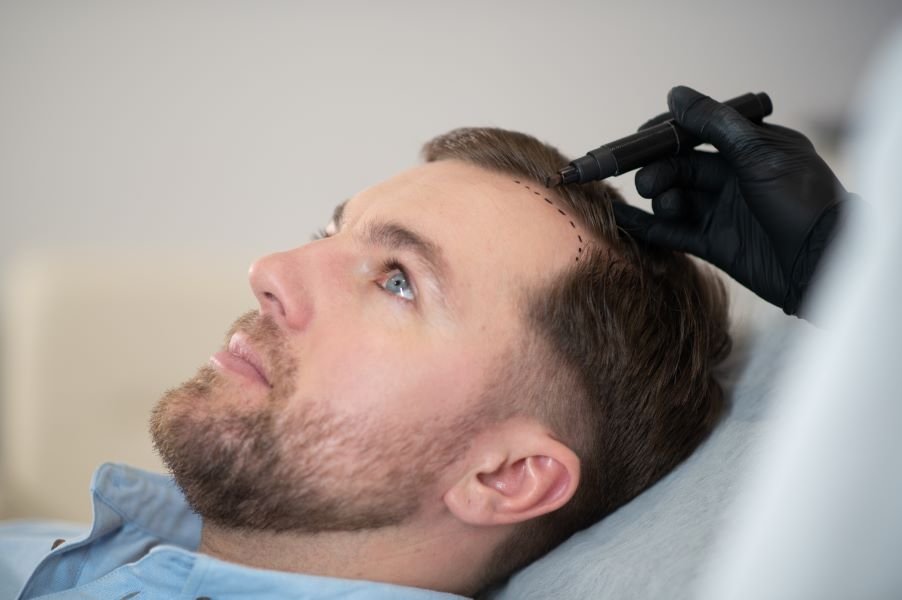 White piedra vs. black piedra